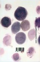 Я їду додому їсти шовковицю з дерева. Image №3