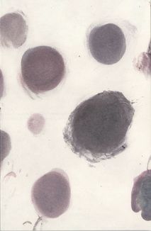 Я їду додому їсти шовковицю з дерева. Image №2